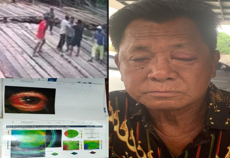 Bapak Dikeroyok Mengalami Mata Kirinya Luka Parah, Amran: CCTV Lengkap dan Hasil Visum